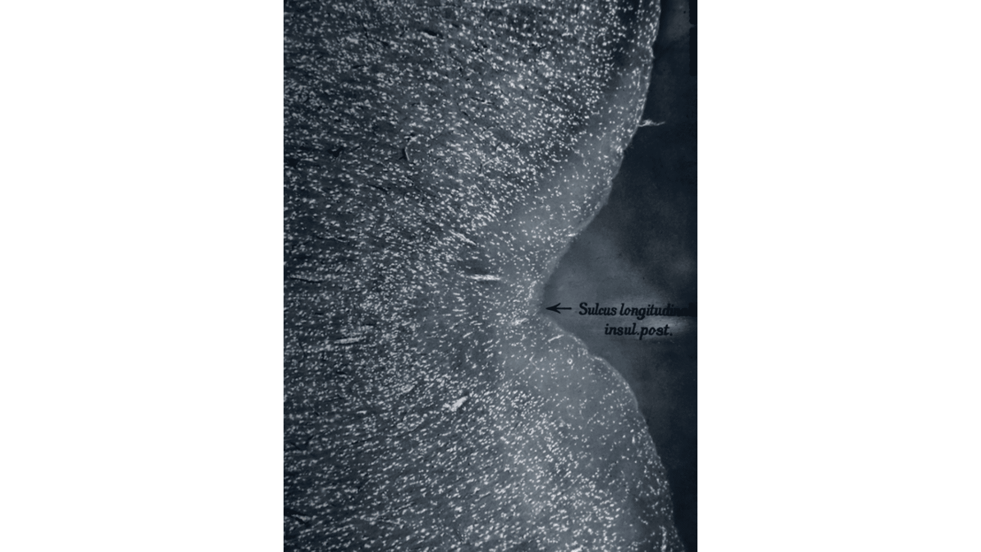 Cartacea Galleria Cartacea Gallery Joan Fontcuberta, Brain: Area Praecentalis Gygantopyramidalis, 2023 | Giclée Print on Hahnemühle Museum Etching Paper, Edition of 3 + 1 AP, 60 x 80 cm