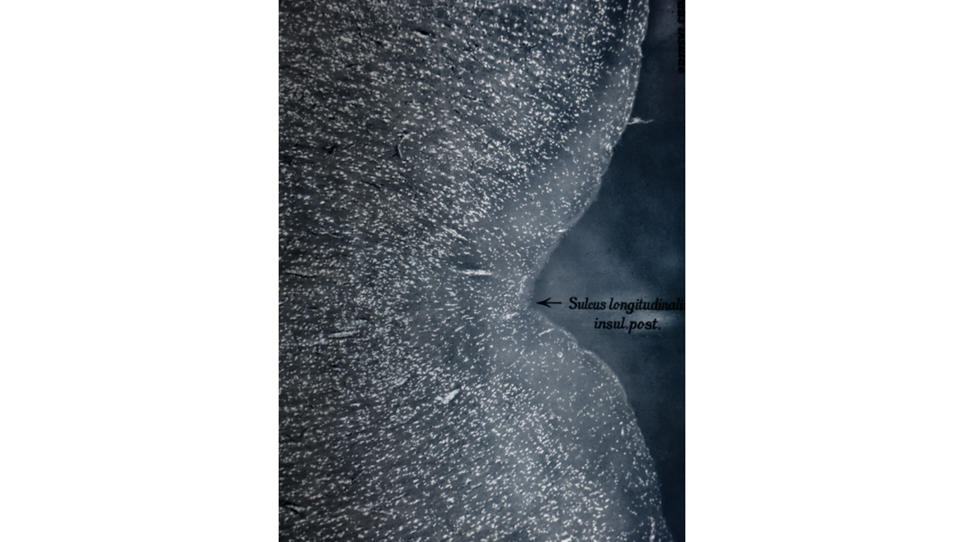 Cartacea Galleria
Cartacea Gallery Joan Fontcuberta, Brain: Area Praecentalis Gygantopyramidalis, 2023 | Giclée Print on Hahnemühle Museum Etching Paper, Edition of 3 + 1 AP, 60 x 80 cm